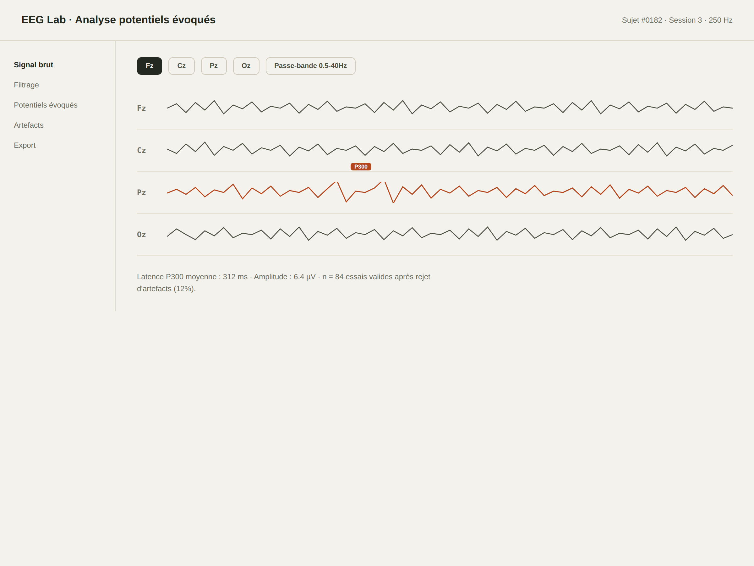 Maquette de l'analyse de données EEG